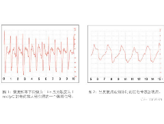 壓電薄膜傳感器在生命特征監(jiān)測(cè)方面應(yīng)用的解決方案